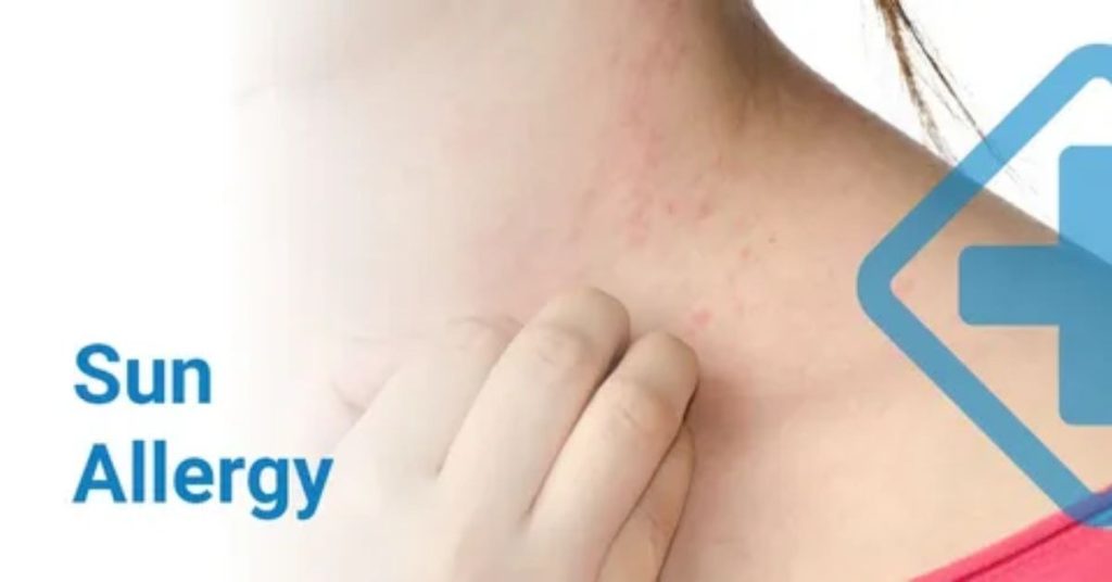 can anxiety cause sneezing